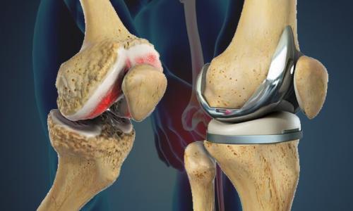 Dr. Sanjiv Kumar – Best Orthopedic Surgeon in Muzaffarpur